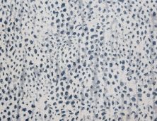Stanton Pop Rock Arctic Blue POPRO-16871-13-2-WV